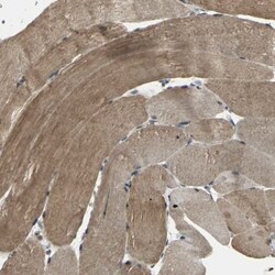 UCH-L5/UCH37 Antibody, Novus Biologicals:Antibodies:Primary Antibodies